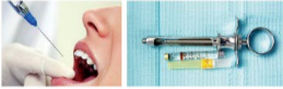 胰島素，牙科麻醉6.png